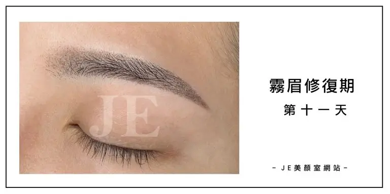 霧眉修復期 