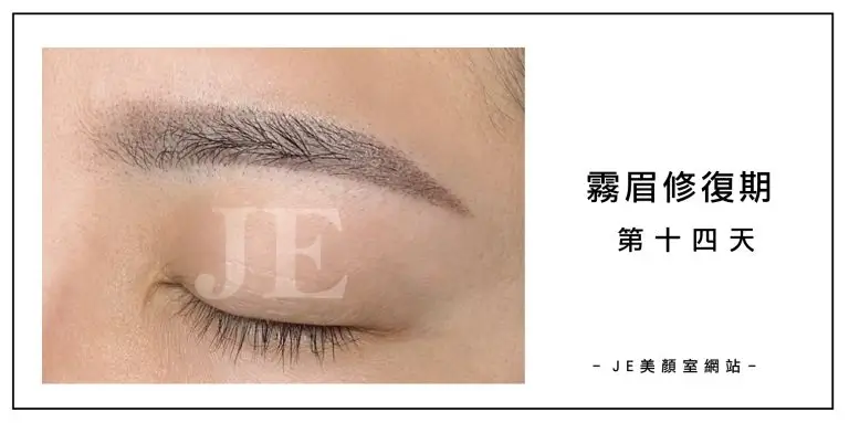 霧眉修復期 