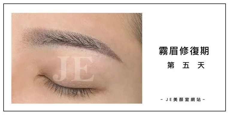 霧眉修復期 
