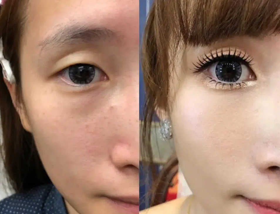 花蓮新秘 - 新娘眼型調整